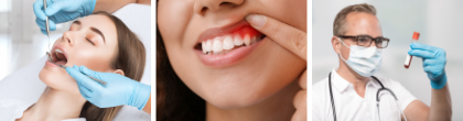 Zahnmedizinische Mikronährstoff-Analyse und Parodontitis